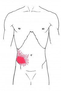 Abdominis rectus smerteområde