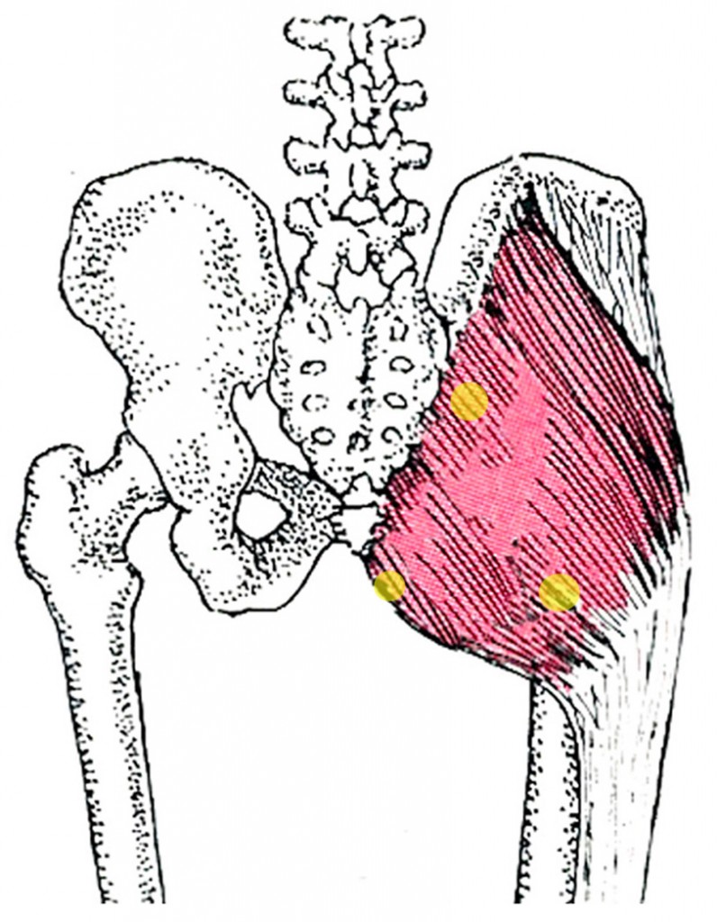 Gluteus maximus_trg Zone44
