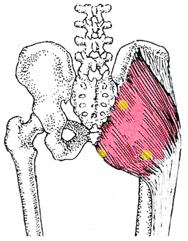 Gluteus Maximustrg Zone44