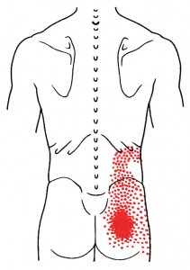 Iliocostalis lumborum smerteområde