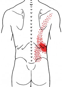 Iliocostalis thoracis smerteområde