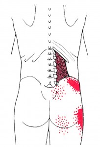 Quadratus lumborum smerteområde