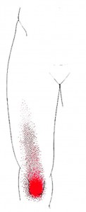 Rectus femoris smerteområde