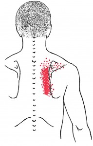 Rhomboideus smerteområde