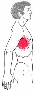 Serratus anterior smerteområde