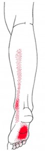 Flexor digitorum longus smerteområde