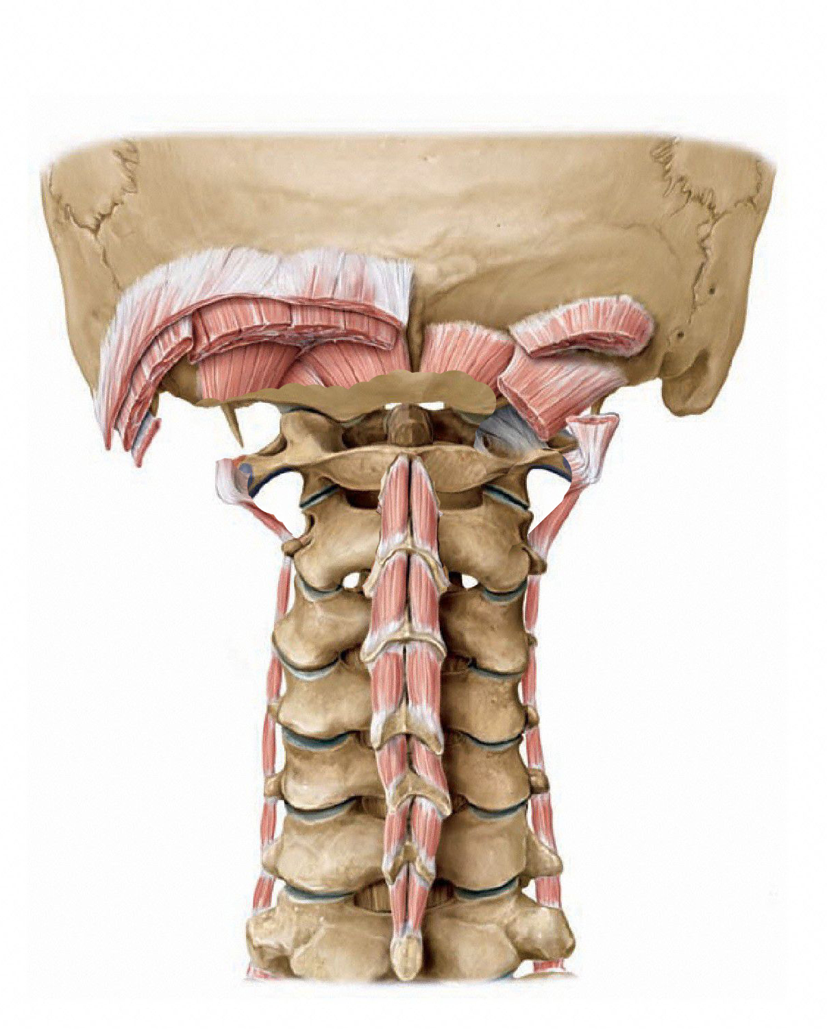 M Intertransversarii laterales Lumborum