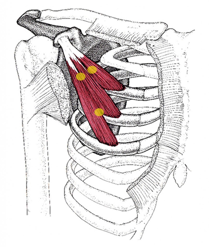 Pectoralis minor_muskel_trg - Zone44