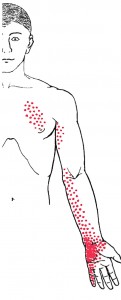 Serratus posterior superior smerteområde